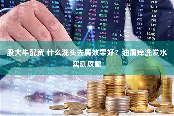 股大牛配资 什么洗头去屑效果好？油屑痒洗发水实测攻略